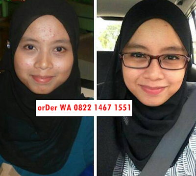 grosir serum collagen, guna serum collagen, harga serum kolagen, harga vitamin c serum collagen, jual serum collagen,