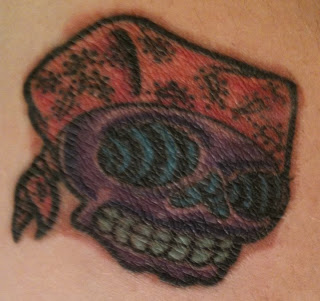 Trichloroacetic Acid (TCA) Tattoo Removal: June 2011