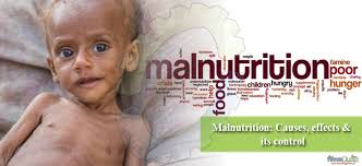Malnutrition