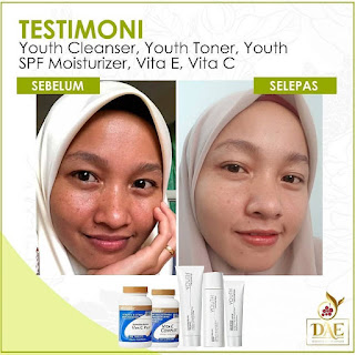 Shaklee Youth Starter Set | Testimoni, Perbezaan, Harga Ahli