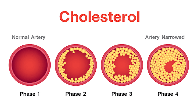 Maintain cholesterol level
