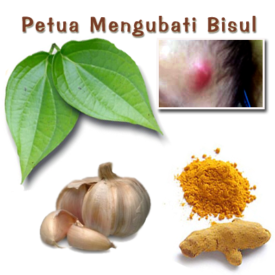 101 Petua: Petua Mengubati Bisul