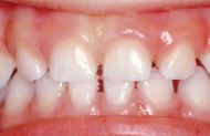 Oral Health - Healthy mouth