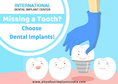 single tooth replacement Chennai