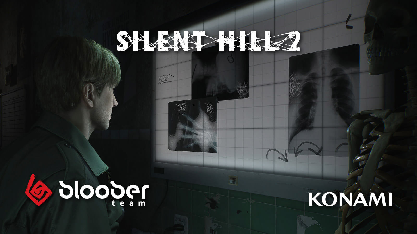 Silent Hill 2: Non-Negotiable Features The Remake Needs