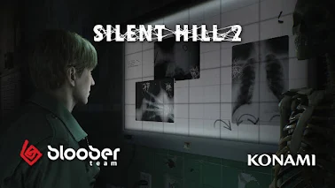 Silent Hill 2 Remake is Near End of Development - Gameslaught