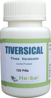Herbal Supplement for Tinea Versicolor