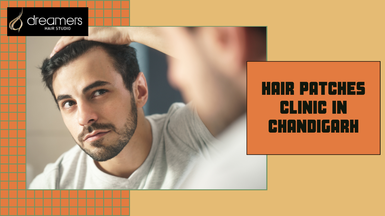Hair patches clinic in Mohali