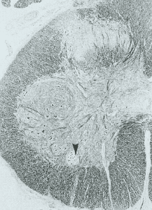 Pathophysiology of erectile dysfunction