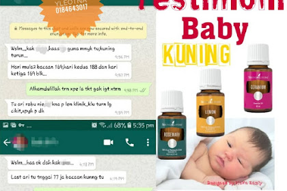 cara turunkan kuning baby
