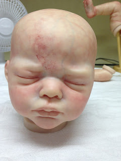   stork bites, stork bite removal, stork bite adults, stork bite vs port wine stain, stork bite birthmark meaning, stork bite treatment, stork bite back of neck meaning, stork bite pictures birthmark, angel kisses birthmark