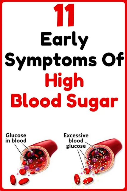 11 High Blood Sugar Signs and Symptoms to Watch Out For