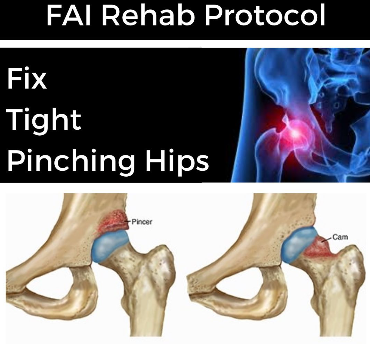 FAI Rehab Protocol Part 1 - themanualtherapist.com