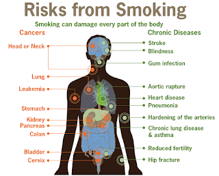 Quit Smoking Or Your Unborn Baby Dies Without You Knowing