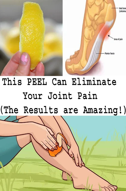 This PEEL Can Eliminate Your Joint Pain (Amazing Results)