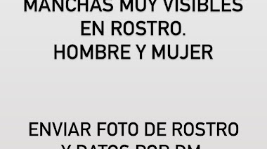 CHILE: Se buscan MODELOS AFRO y HOMBRES y MUJERES con VITILIGO, MUCHAS PECAS, ACNÉ, ETC