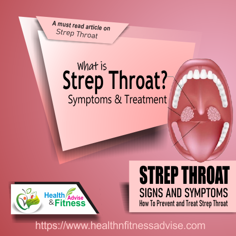 Strep Throat: Contagious, Symptoms, Causes, Diagnosis, and Treatment
