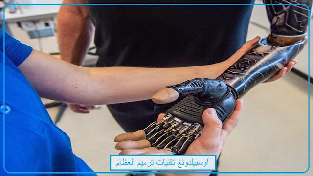 اوسبيلدونغ Orthopädietechnik-Mechaniker في المانيا 2020