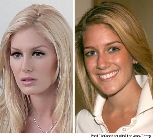 heidi montag surgery. dresses Heidi Montag showing