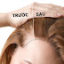 Đến dầu gội kích thích mọc tóc cũng phải "nể phục" hiệu quả của 3 giải pháp tự nhiên này