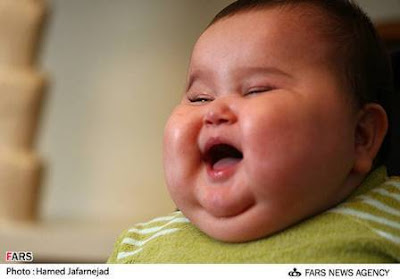 Unbeliveable 20 kg baby born in Tehran,Iran