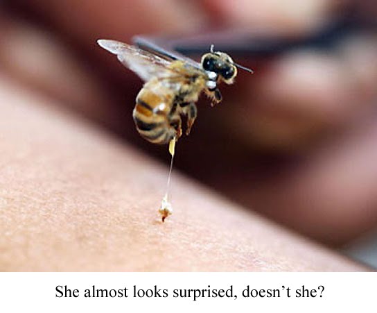 I've Got Hives!: Bee Informed, Part 4: The Sting