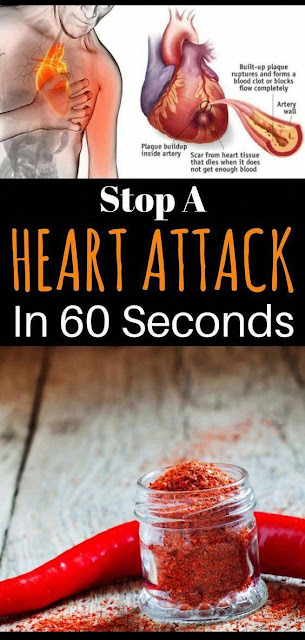 How To Stop A Heart Attack In Just 1 minute - It's Very Popular Ingredient In Your Kitchen