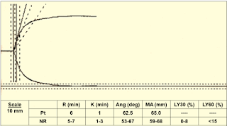 Viscoelastic Measures of Coagulation