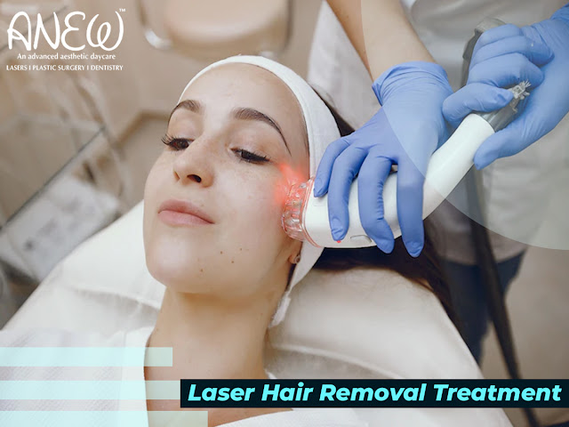 Laser Hair reduction in Bangalore