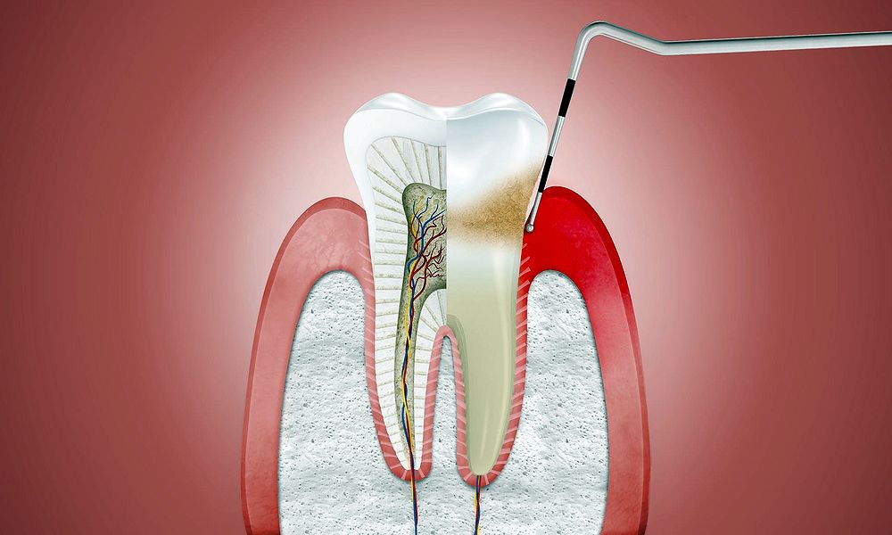 Periodontics