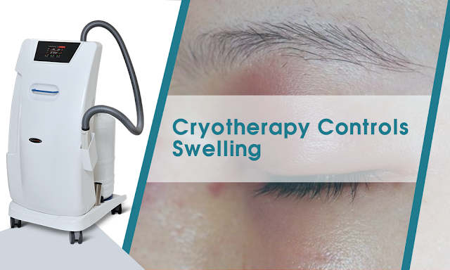 Cryotherapy controls swelling