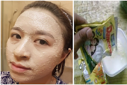 Wajah Berminyak, Jerawat, Flek Hitam dan Mata Panda Hilang Seketika Dengan Masker Susu Dancow