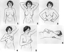 Breast health