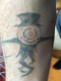 Tattoo fading after 4 q-switched sessions