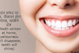 दांत सफेद घर पर, पीलापन होगा गायब, चमकेंगे दांत (Teeth whiten at home, yellowness will disappear, teeth will shine)