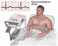 CONTOH ALAT ELEKTROKARDIOGRAFI  ECG