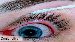 Common eye problems occurs in rainy season, treatment and prevention tips, Conjunctivitis