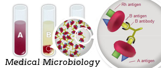 antigen-antibody reaction