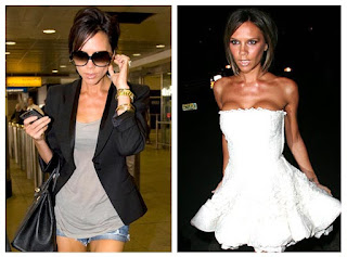 Victoria Beckham Breast Implants