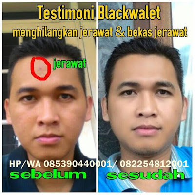 http://bisnisblackwalet.com/sabunmuka