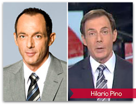 Hilario Pino: antes y después de su tratamiento capilar 2005-2010