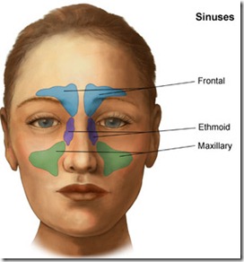 sinusitis