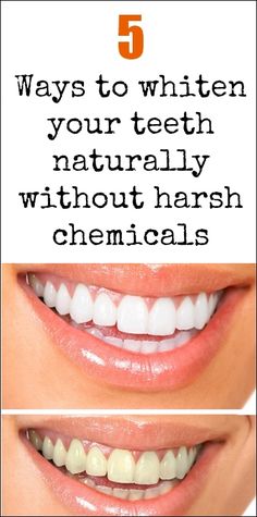 5 Ways to Clean teeth Naturally
