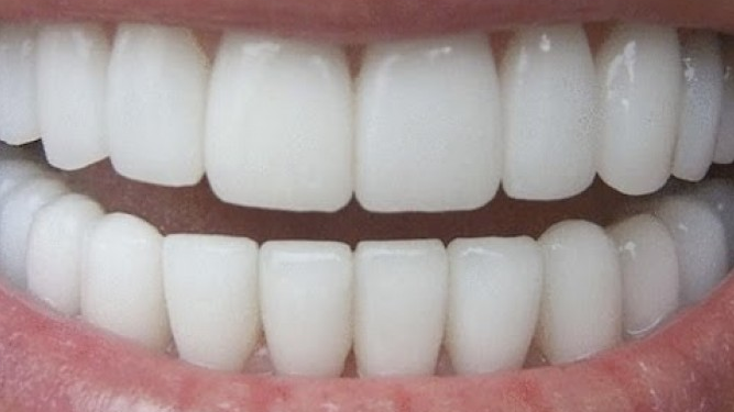 How To Whiten Your Teeth In 3 Minutes