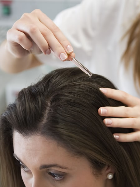 Consejos para prevenir la alopecia