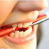 Răng sứ cercon zirconia là gì?