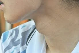 Amazing Facts About "Adam's Apple"