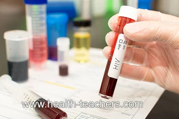 What is HIV infection - Health-Teachers