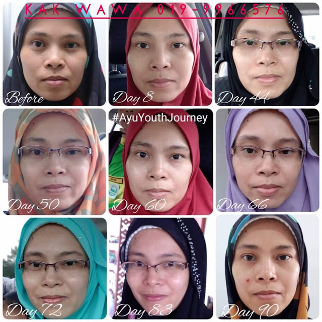 promosi shaklee, promosi may 2018 shaklee, promosi coqtrol, promosi vitamin c, promosi youth skincare, Youth dijual loose May 2018, testimoni youth skincare shaklee