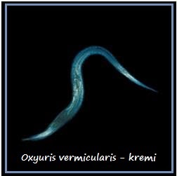 CACING KREMI OXYURIS VERMICULARIS 